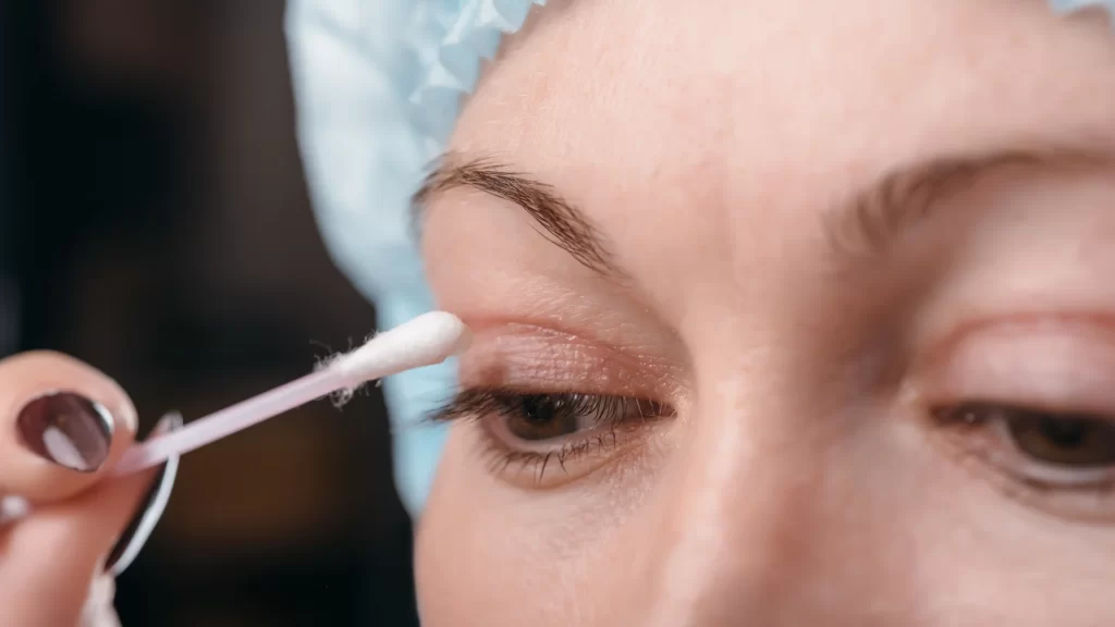 Göz Kapağı Ameliyatı