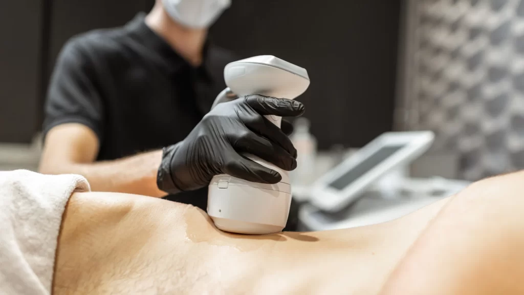 Lazer Liposuction İşlemi