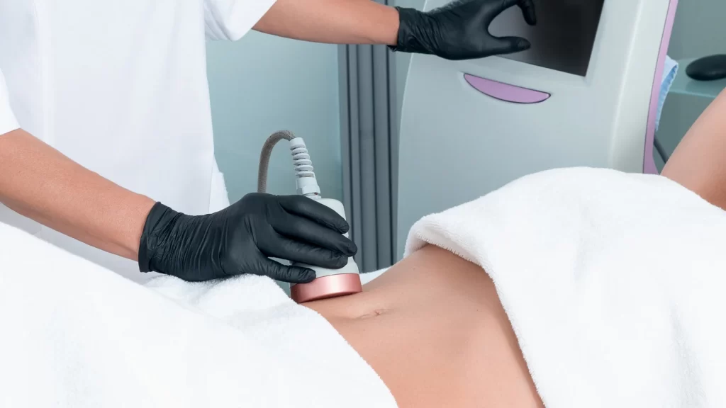 Lazer Liposuction Sonrası Deri Sarkması Olur mu?