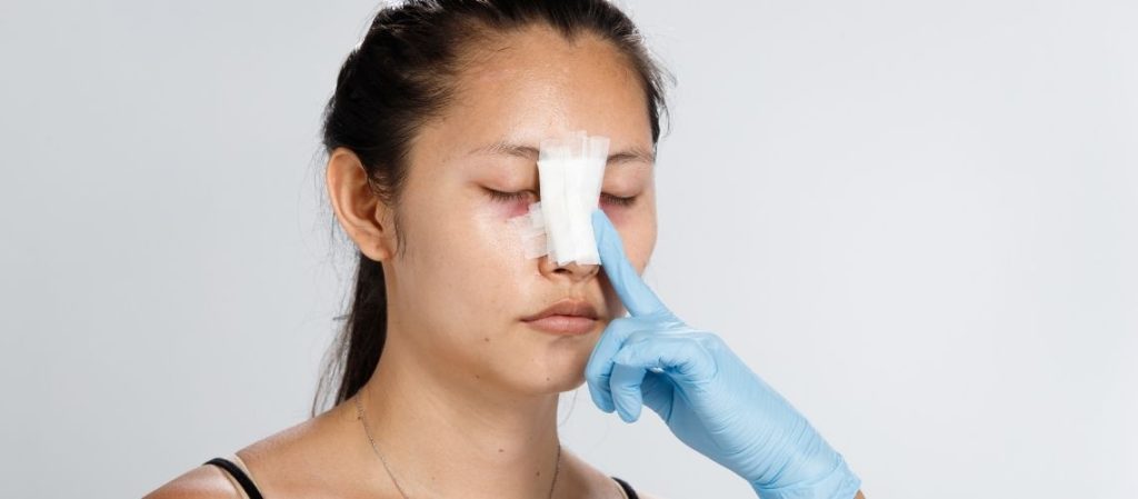 Burun Estetiği Sonrası