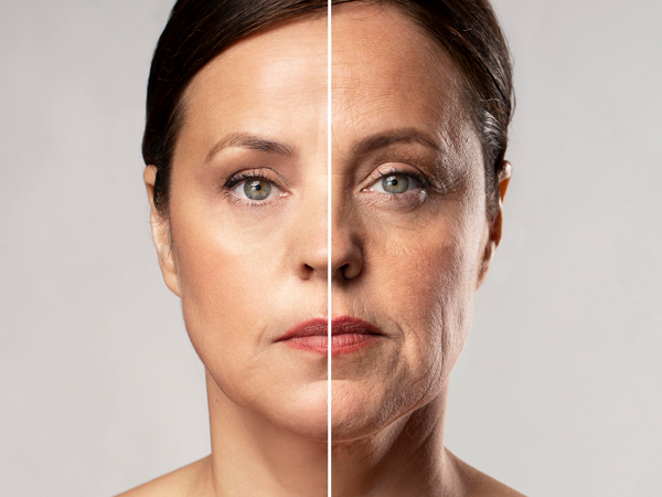 Yüz germe ameliyatı